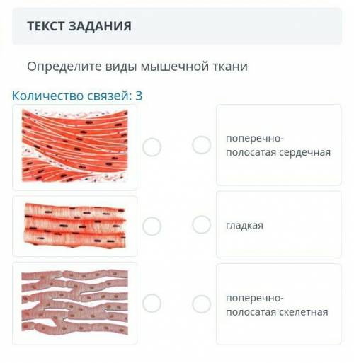 определите виды мышечной ткани. поперечно-полосатая сердечная гладкая поперечно-полосатая скелетная.