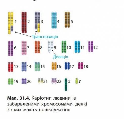 Зробіть хромосомний аналіз каріотипу, який зображено на малюнку і визначте, які порушення мають хром