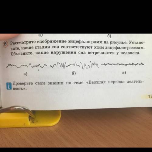 15) Рассмотрите изображение энцефалограмм на рисунке. Устано- вите, какие стадии сна соответствуют э