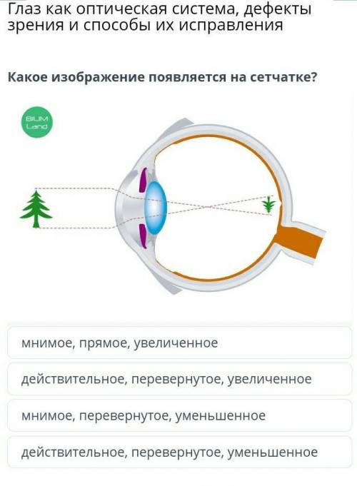 Глаз как оптическая система, дефекты зрения и их исправления Какое изображение появляется на сетчатк