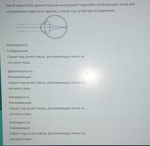 Какой недостаток зрения показан на рисунке? Нарисуйте необходимую линзу для исправления недостатка з