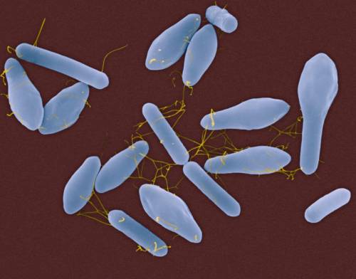 Почему клетки Clostridium Butyricum подвижны???