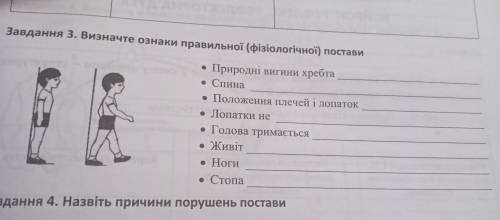 Визначте ознаки правельної (фізичної) постави