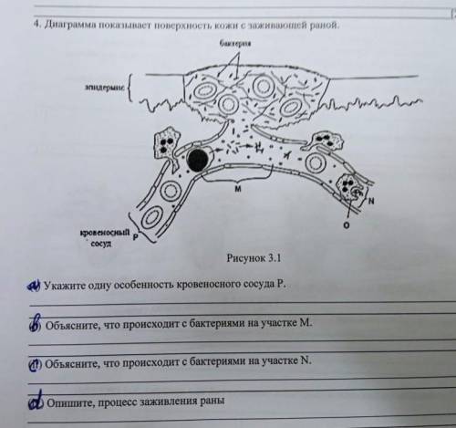 Диафрагма показывает поверхность кожи с заживающей раной